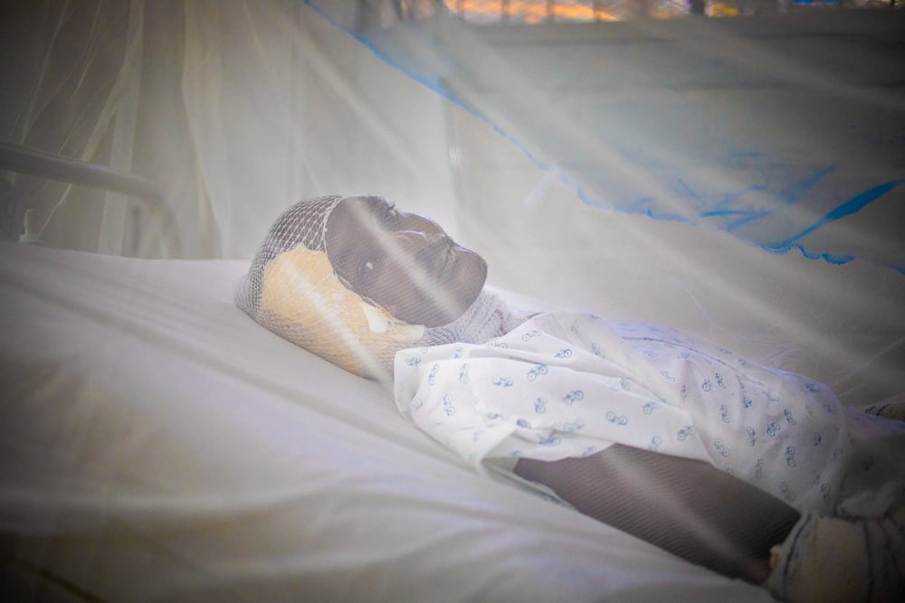MSF support of burnt patients in September explosion