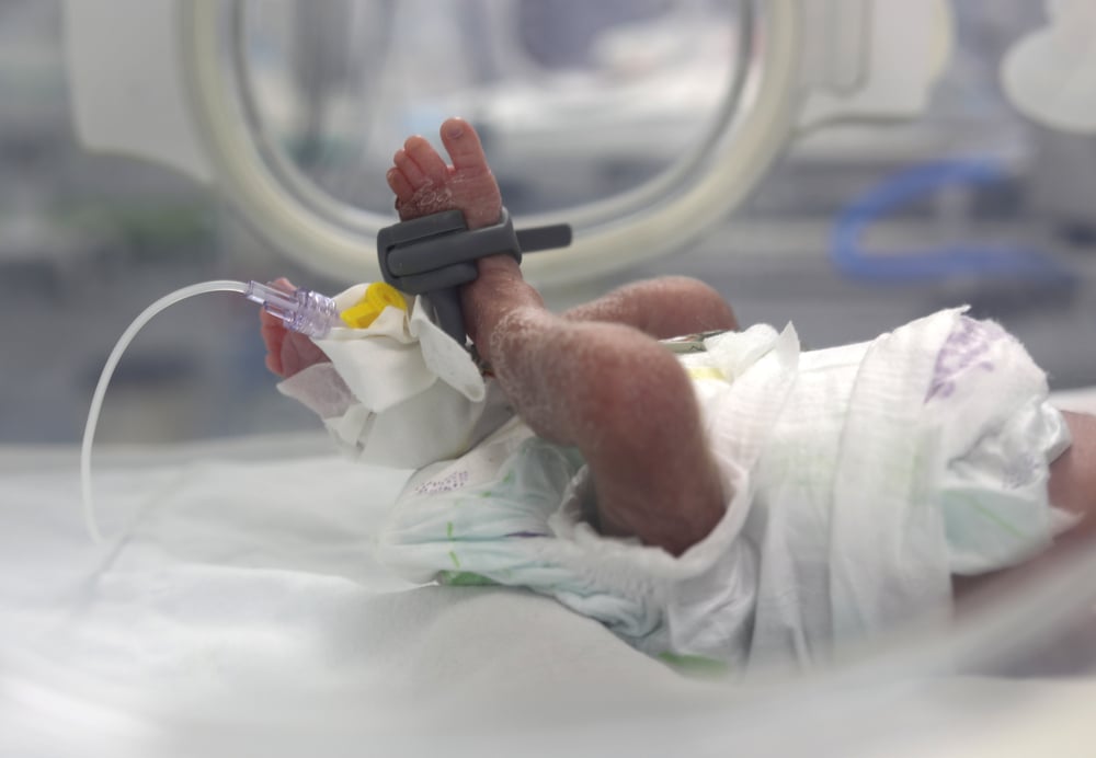 A newborn baby under monitoring at the MSF- supported neonatal intensive care unit of Nasser Hospital, Khan Younis, Gaza.