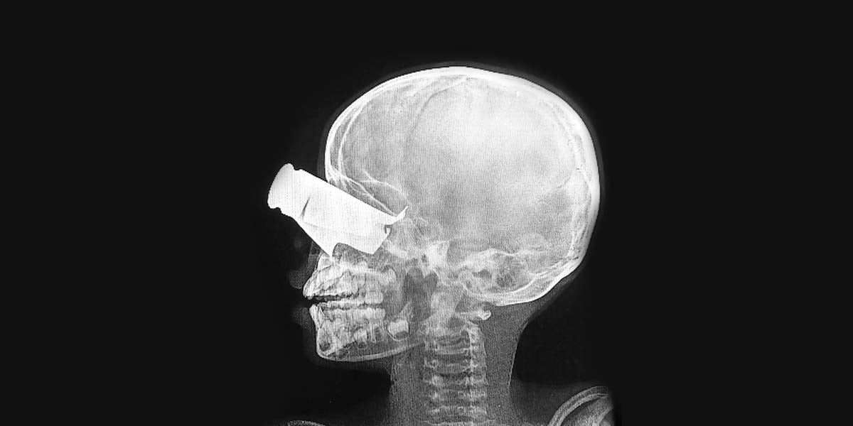 X-ray
