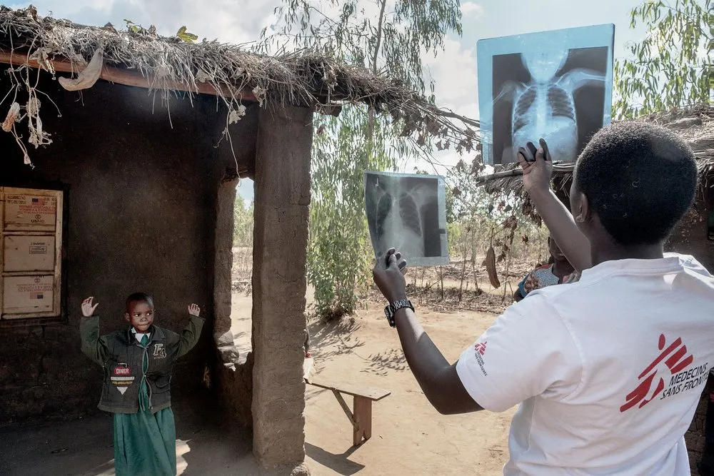 Chiradzulu: HIV care for adolescents