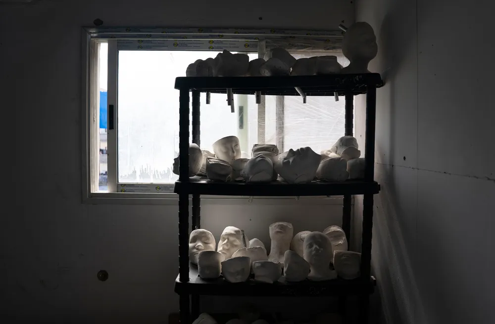 Casts of patients’ faces