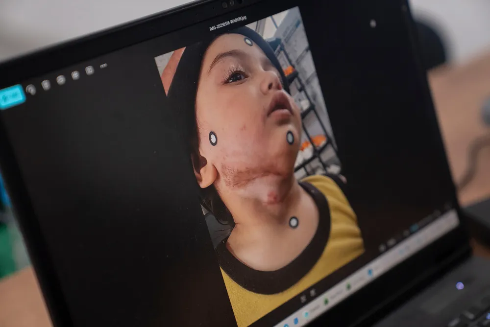 Scanning a child's face.