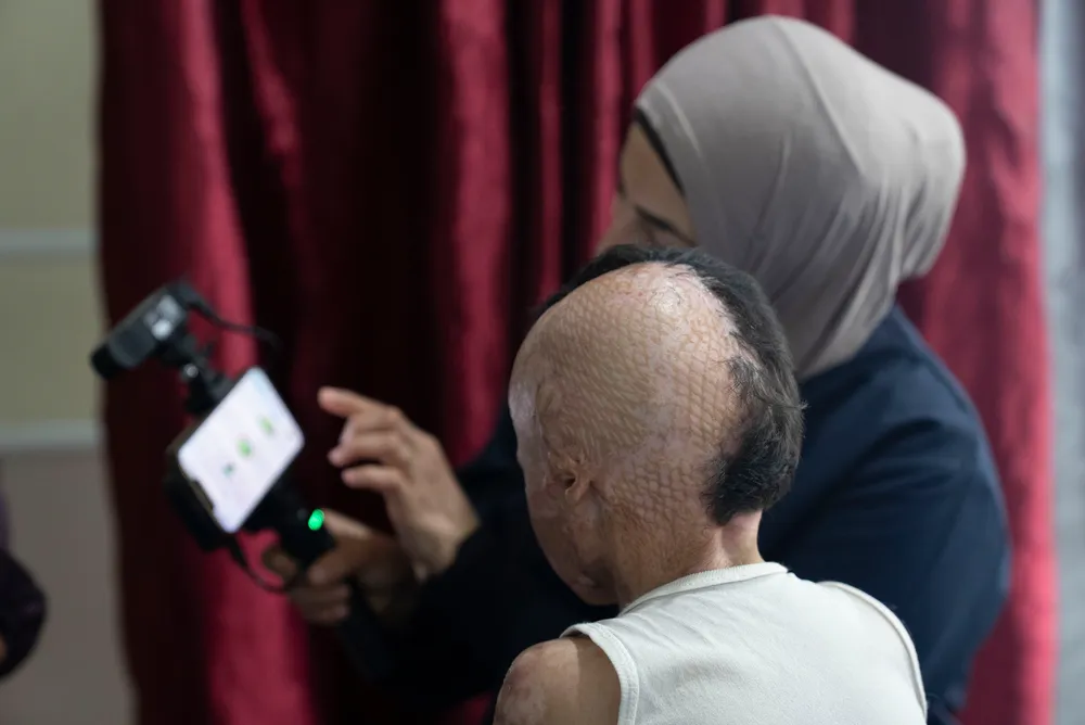 Physiotherapist shows Joud how the 3D scanner works