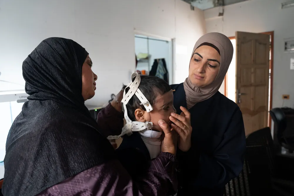 An MSF physiotherapist fits a 3D-printed mask on Joud, a four-year-old burn patient