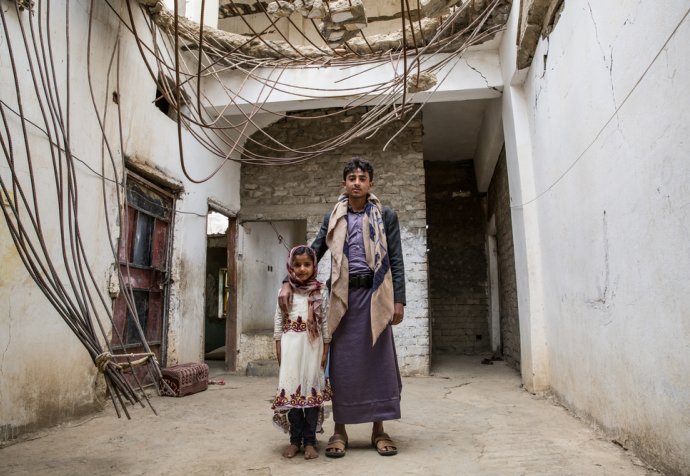 North Yemen: living under daily coalition airstrikes